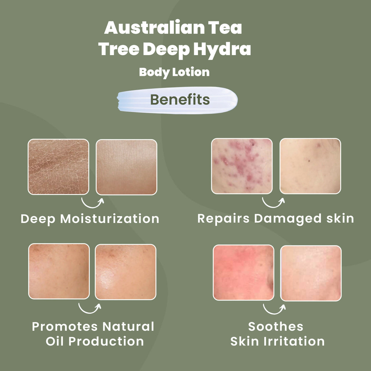 Wild Oak Shea Butter & Australian Tea Tree Body Lotion - Distacart