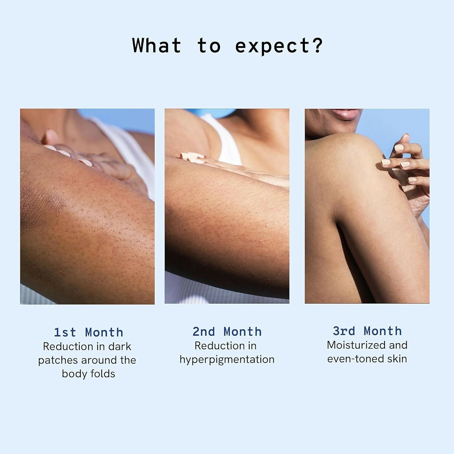 BeBodywise Pigmentation Repair Cream - Distacart
