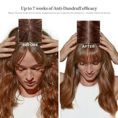 Kerastase Symbiose Bain Pureté Anti-Dandruff Shampoo - Distacart
