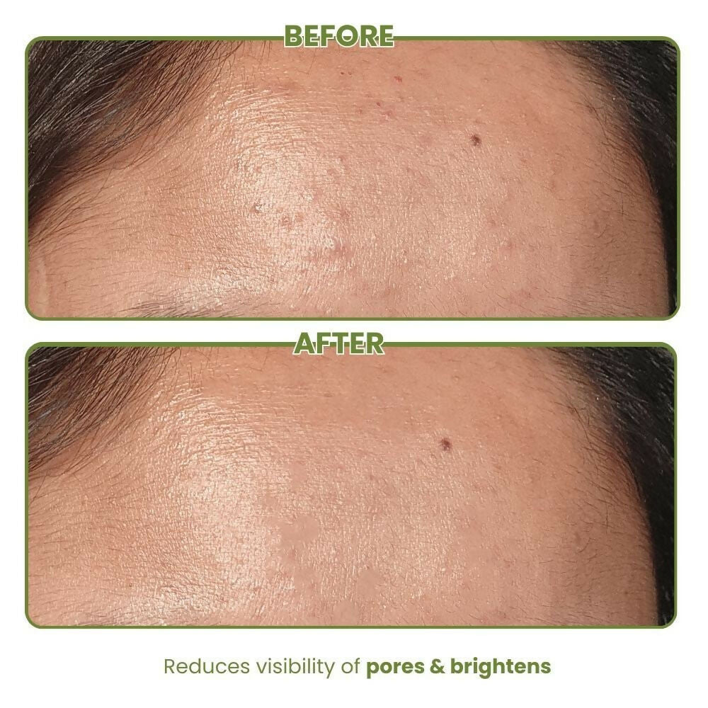 0b90bafTHEDO00000002_2260424