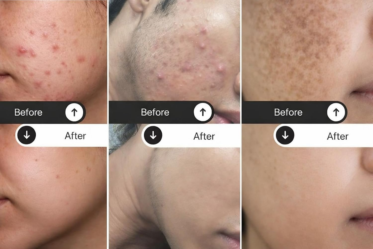 Milky Moon Kumkumadi Cream for Pigmentation & Wrinkles Night Cream - Dista