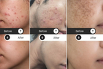Thumbnail for Milky Moon Kumkumadi Cream for Pigmentation & Wrinkles Night Cream - Dista