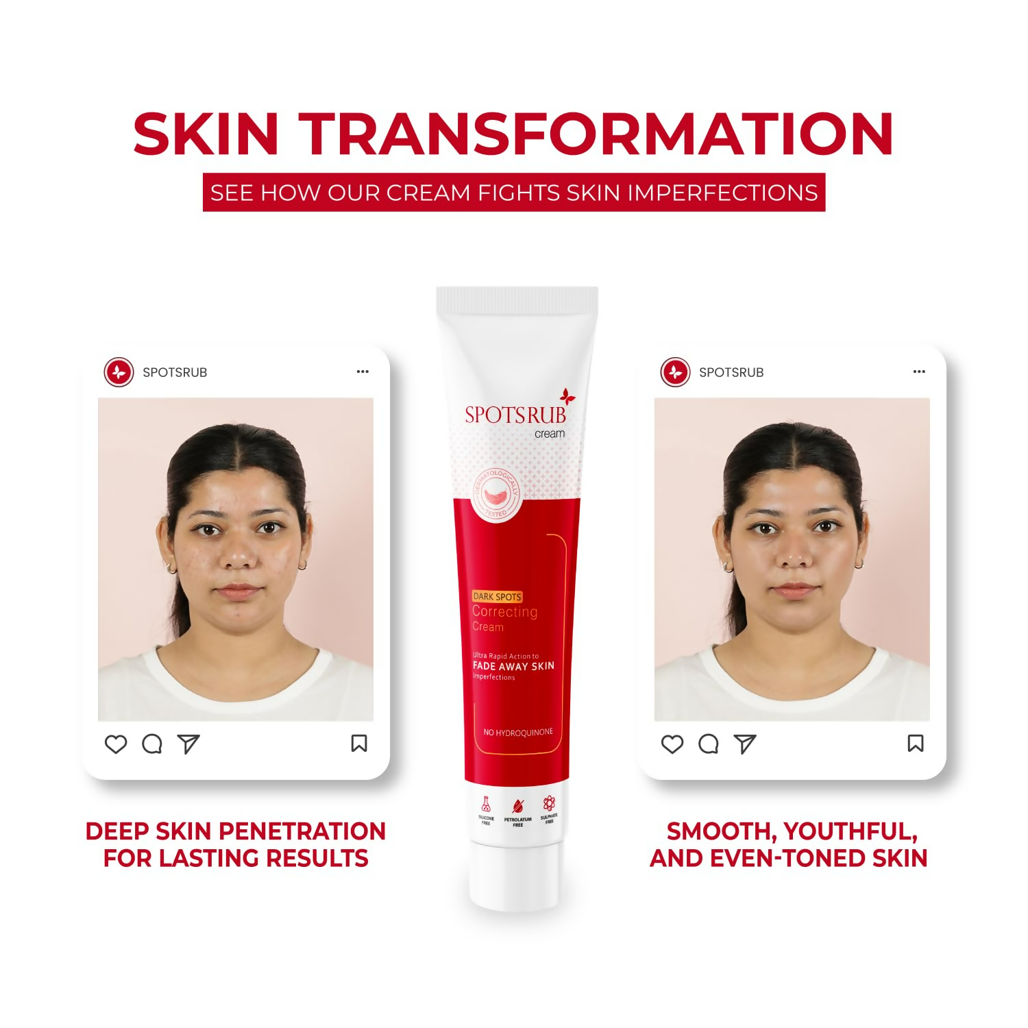 Leeford Spotsrub Face Cream For Women