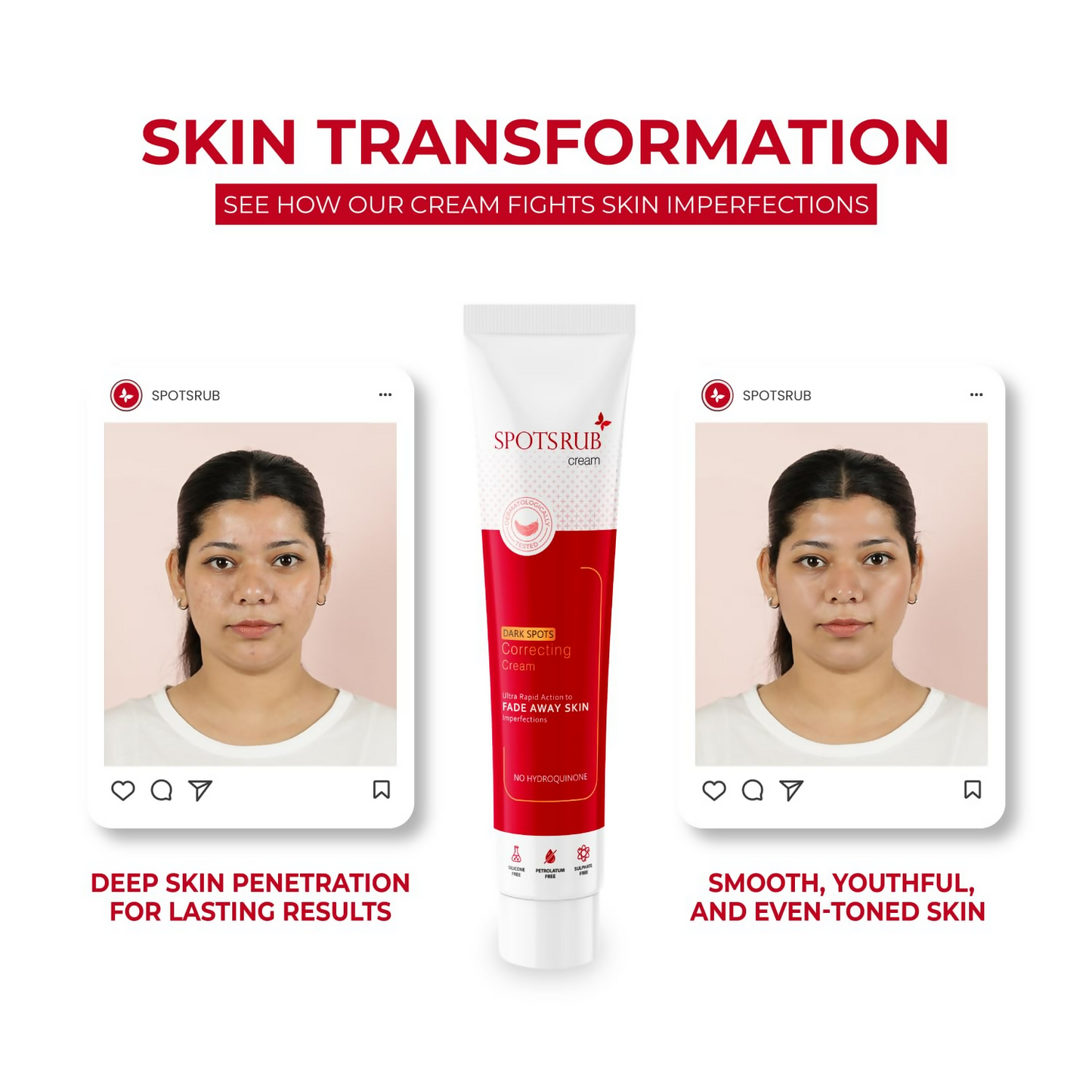 Leeford Spotsrub Face Cream For Women - Distacart