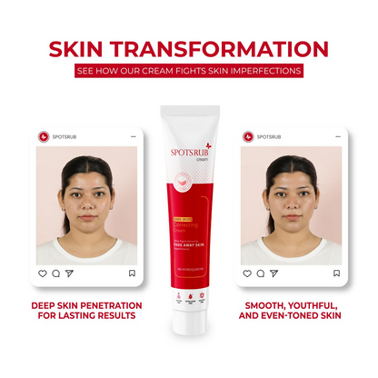 Leeford Spotsrub Face Cream For Women - Distacart