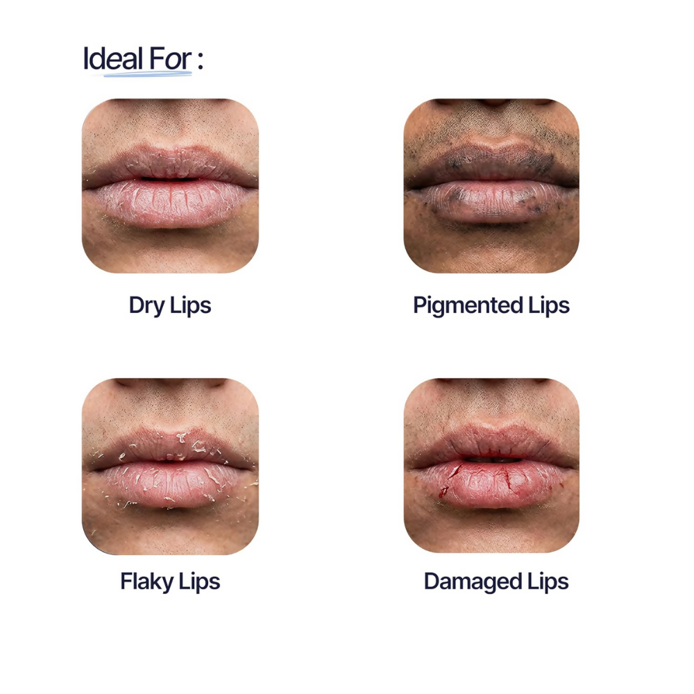 Mannlich Lip Balm For Men - Dista