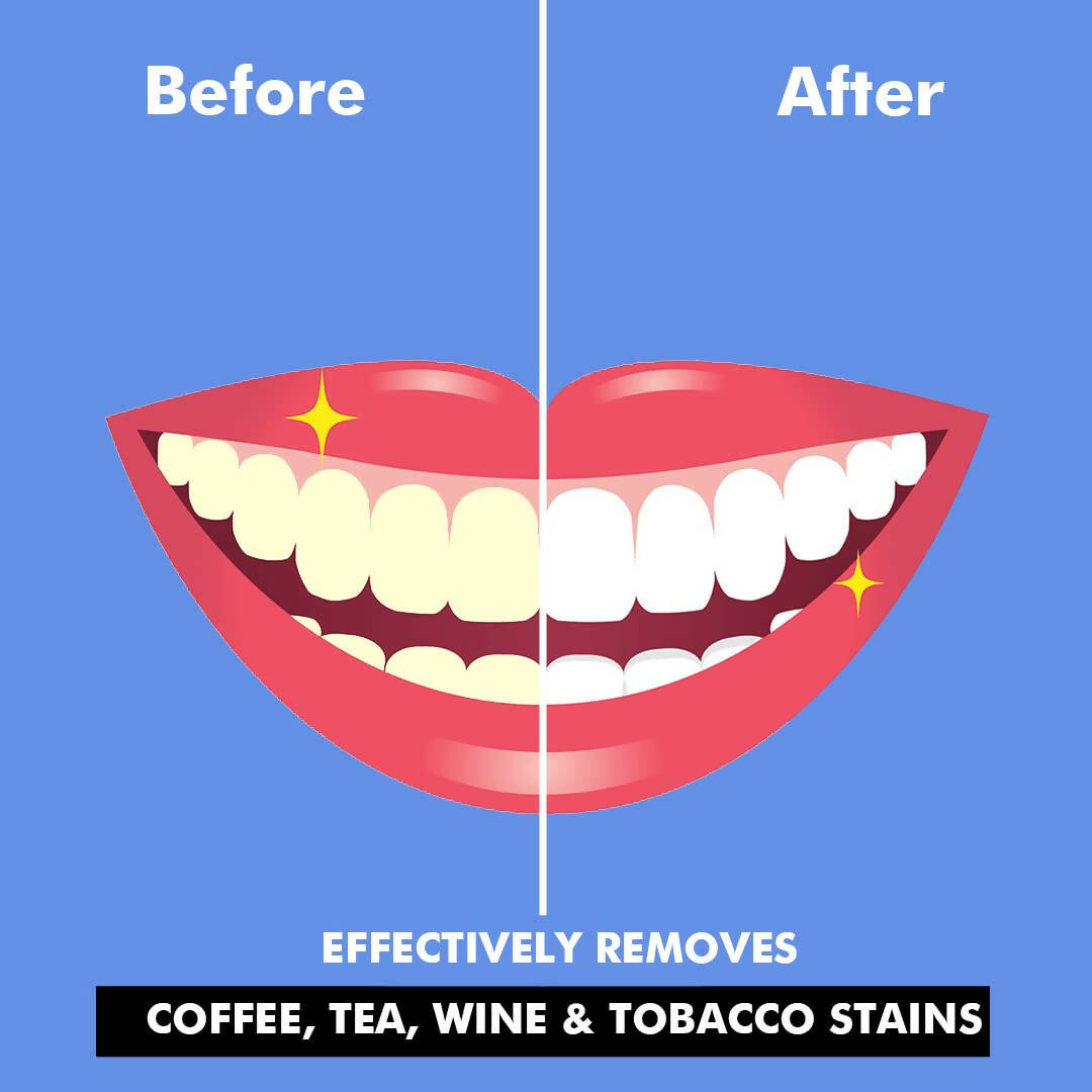 Perfora Teeth Whitening Powder - Distacart