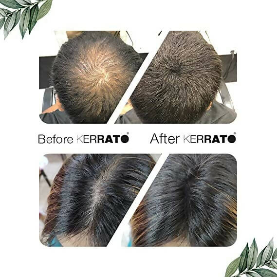 Kerrato Hair Fibres For Thinning Hair (Natural Black) - Distacart
