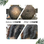Thumbnail for Kerrato Hair Fibres For Thinning Hair (Natural Black) - Distacart