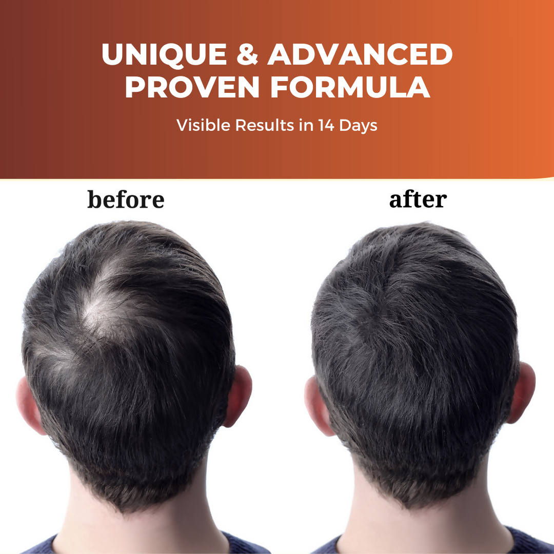 Prisa Organics Hair Re Growth Serum - Distacart