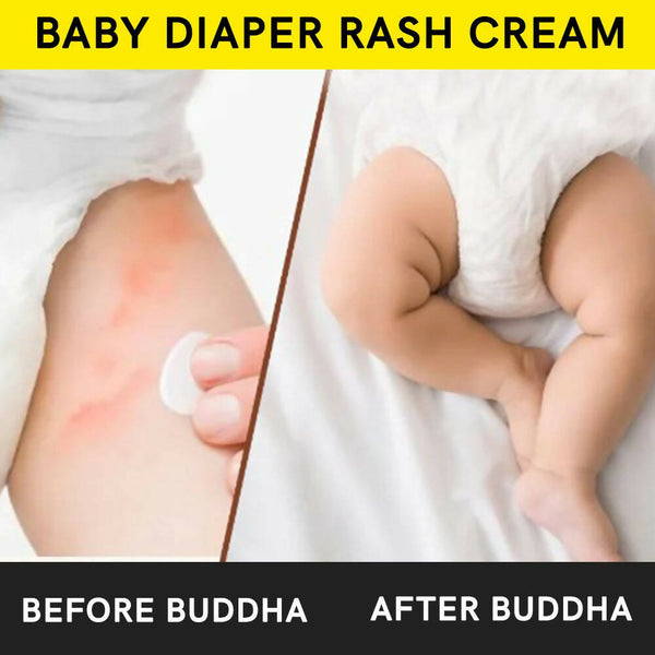 Buddha Natural Baby Diaper Rash Cream - Distacart