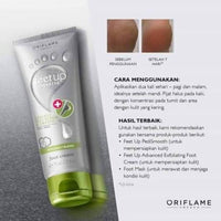 Thumbnail for Oriflame Feet Up Advanced Cracked Heel Repair & Smooth Foot Cream benefits