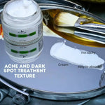 Thumbnail for The Wellness Shop Acne and Dark Spot Treatment Cream - Distacart