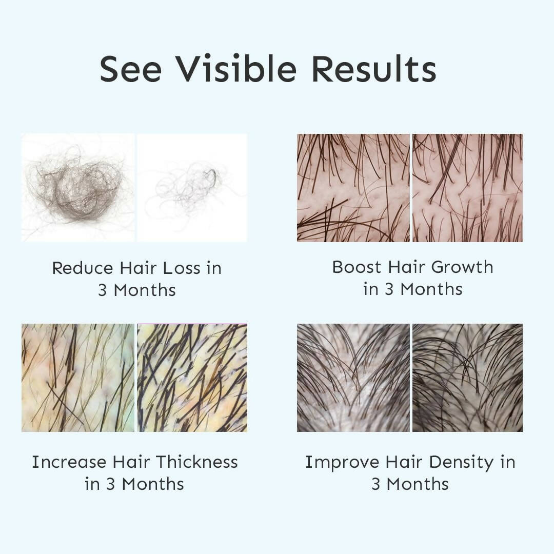 Arata Intensive Hair Growth Serum - Distacart