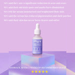 Thumbnail for Natural Vibes Acne & Dark Spot Corrector Face Serum - Distacart