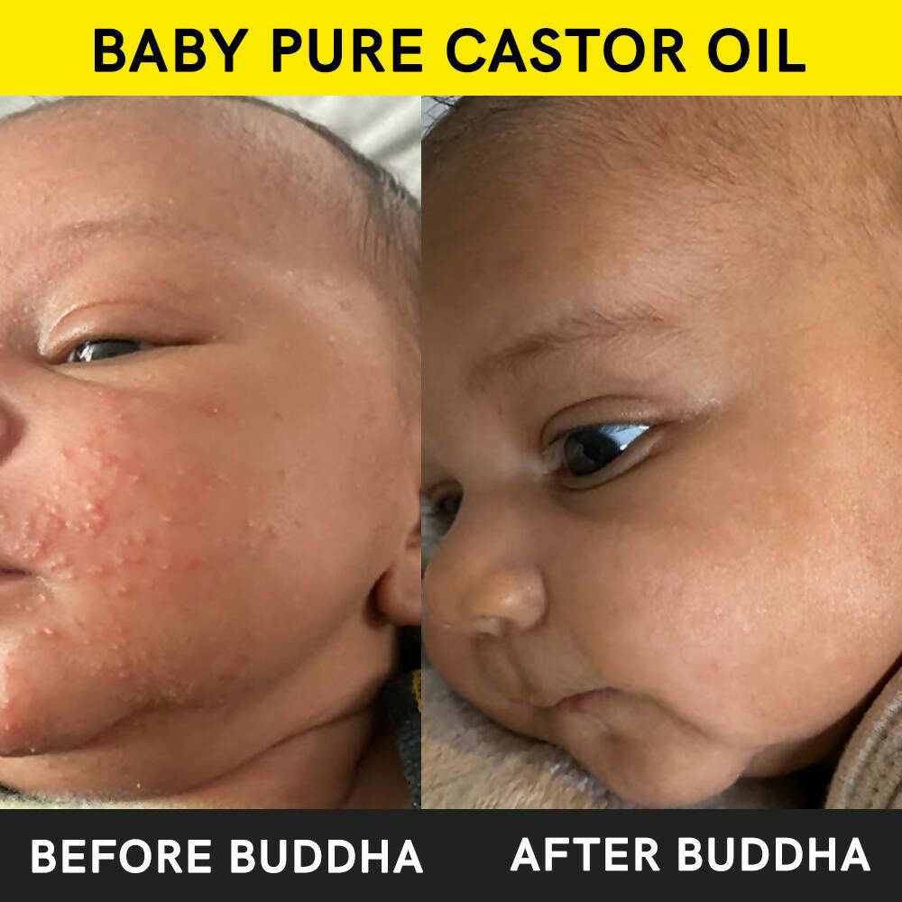 Buddha Natural Baby Castor Oil Cold Pressed Extra Virgin - Distacart