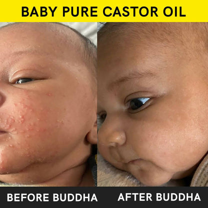 Buddha Natural Baby Castor Oil Cold Pressed Extra Virgin - Distacart