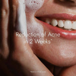 Thumbnail for Kapiva Ayurveda Skin Rituals Acne Control Tulsi Face Wash - Distacart