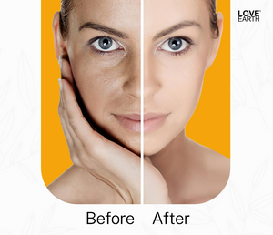 Love Earth Anti Blemish & Pigmentation Cream - Distacart