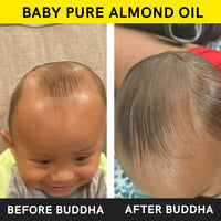 Thumbnail for Buddha Natural Baby Almond Oil Extra Virgin Wood Pressed - Distacart