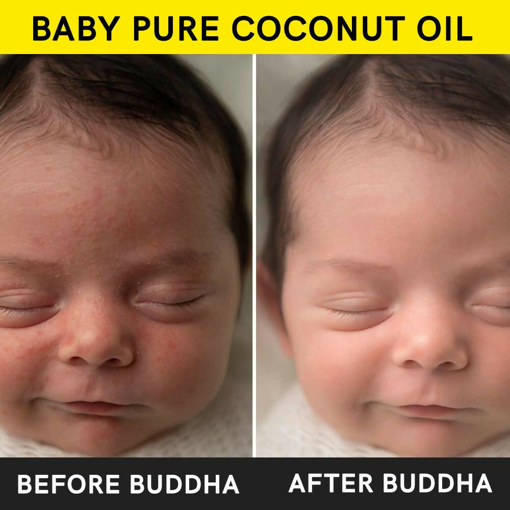 Buddha Natural Baby Coconut Oil Extra Virgin Wood Pressed - Distacart