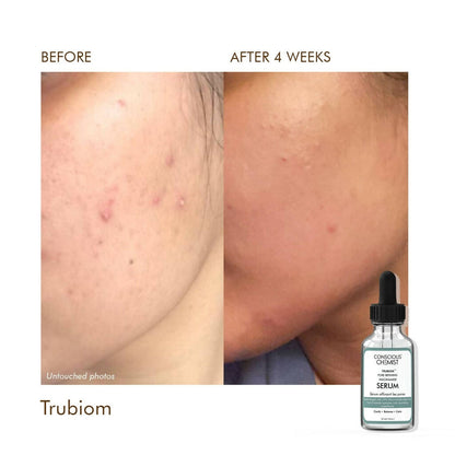Conscious Chemist Trubiom Pore Refining Niacinamide Serum - Distacart