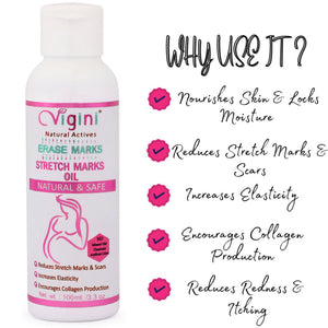 Vigini Natural Actives Stretch Marks Scars Removal Cream Oil - Distacart