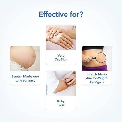 The Moms Co Stretch Marks Bundle - Distacart