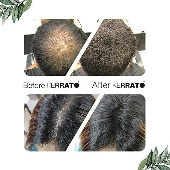 Kerrato Hair Fibres For Thinning Hair - Jet Black - Distacart