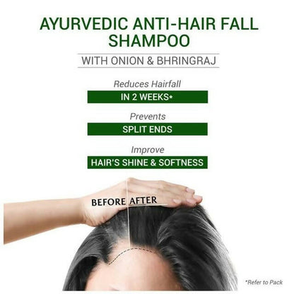 Sesa Ayurvedic Anti-Hair Fall Onion Shampoo - Distacart
