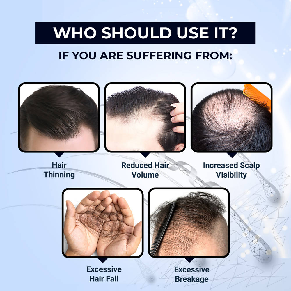 The Man Company Hair Growth Tonic - Distacart