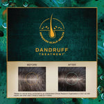 Thumbnail for Indulekha Svetakutaja Anti-Dandruff Hair Oil - Distacart