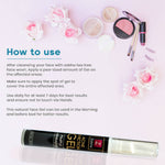 Thumbnail for Zobha Acne Eviction Gel Pimple Minimizer How to Use