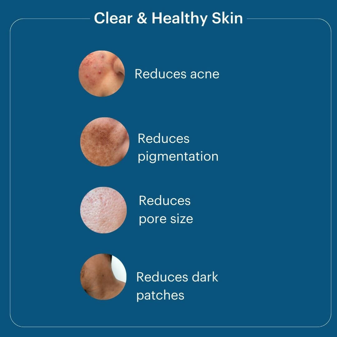 Laurik Skin Vitamins + Anti-Pigmentation Serum For Men - Distacart